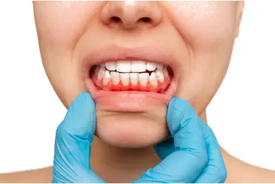 Clinica Dental en Boadilla del Monte