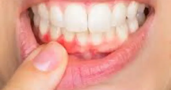Periodoncia en Boadilla del Monte